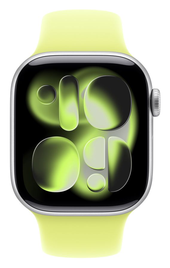MFGC4ZM/A Armband S/M Apple Watch Models 38mm 40mm 41mm 42mm  (Gelb) 