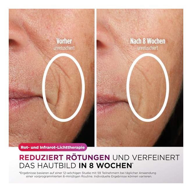FW312EUPL CryoGlow LED-Maske + Kühlung der Augenpartie 