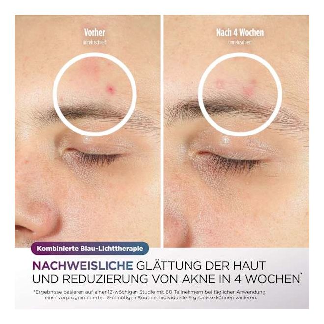 FW312EUPL CryoGlow LED-Maske + Kühlung der Augenpartie 